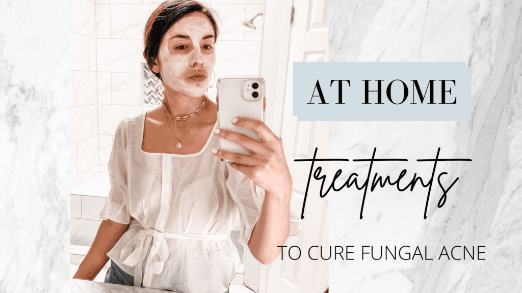 Best Home Treatment For Fungal Acne