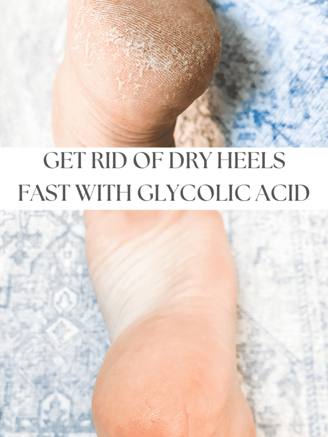 How to Get Rid Of Dry Heels Fast With Glycolic Acid