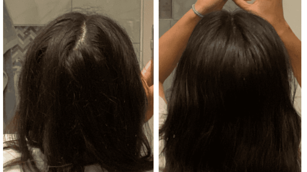 how to get rid of back part in hair