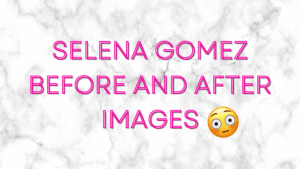 selena gomez before and after