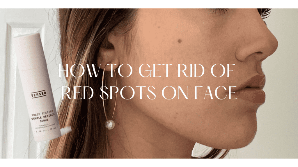 how to get rid of red spots on face